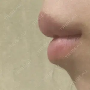 フィラークリニック フィラークリニック 大阪梅田院口コミ