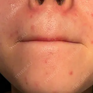 ルラ美容クリニック ルラ美容クリニック 大宮院 / ルラスキンクリニック 大宮院口コミ