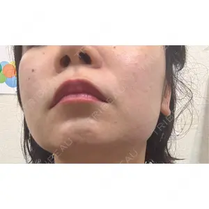 ルラ美容クリニック ルラ美容クリニック 新宿院口コミ