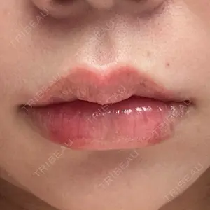 ルラ美容クリニック ルラ美容クリニック 新宿院口コミ