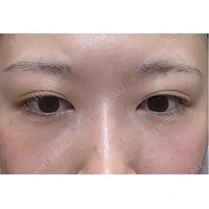 APOLLO BEAUTY CLINIC口コミ