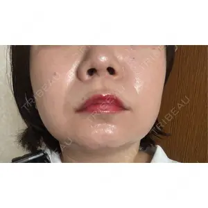 ルラ美容クリニック ルラ美容クリニック 新宿院口コミ