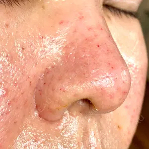 ゆきスキンクリニック 東池袋口コミ