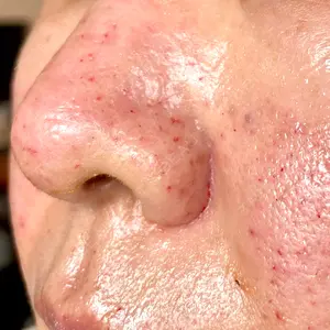 ゆきスキンクリニック 東池袋口コミ