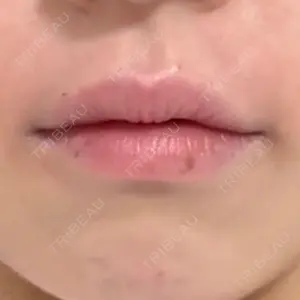 フィラークリニック フィラークリニック 大阪心斎橋院口コミ