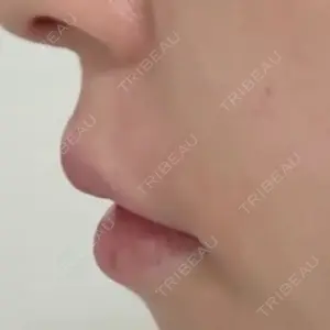 フィラークリニック フィラークリニック 大阪心斎橋院口コミ