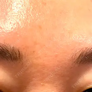 ゆきスキンクリニック 東池袋口コミ