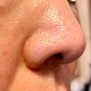 ゆきスキンクリニック 東池袋口コミ