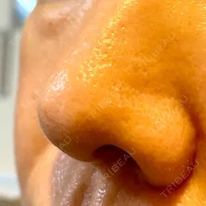 ゆきスキンクリニック 東池袋口コミ