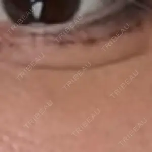 ヴェリテクリニック ヴェリテクリニック 名古屋院口コミ