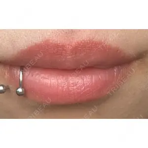 フィラークリニック フィラークリニック 大阪梅田院口コミ