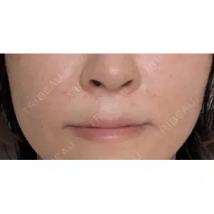 MKクリニック MKクリニック 日本橋院口コミ