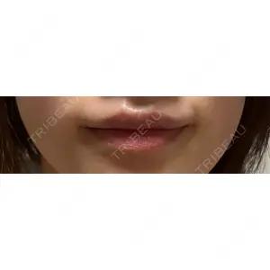 アリエル美容クリニック アリエル美容クリニック 横浜院口コミ