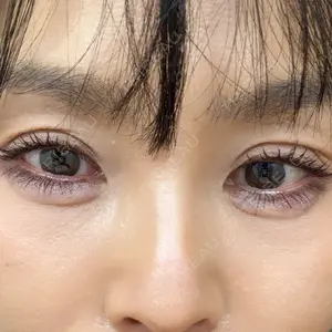 ルラ美容クリニック ルラ美容クリニック 池袋院口コミ