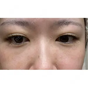 APOLLO BEAUTY CLINIC口コミ