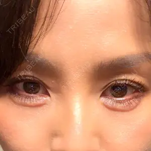 ルラ美容クリニック ルラ美容クリニック 池袋院口コミ