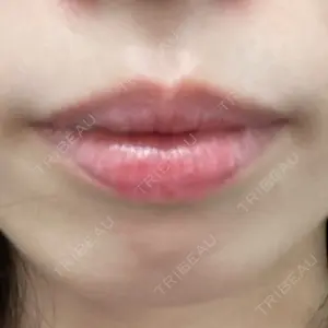 プロクリニック PRO CLINIC プロクリニック 銀座院口コミ