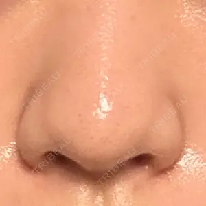 聖心美容クリニック グループ S-Laboクリニック 渋谷院口コミ