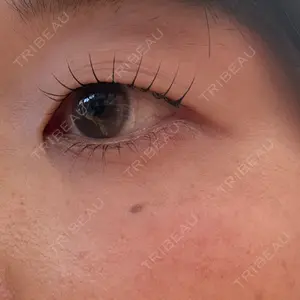 ヴァージンクリニック ヴァージンクリニック 広島院口コミ