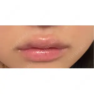 アリエル美容クリニック アリエル美容クリニック 横浜院口コミ