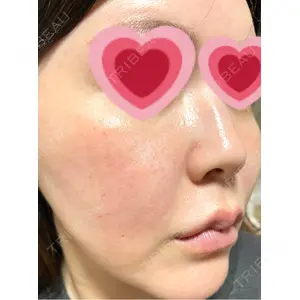 CZEN CLINIC 銀座院口コミ