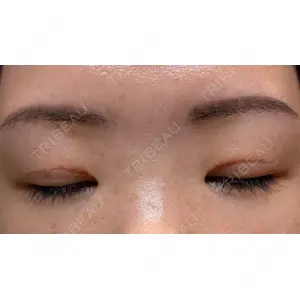 Bellefeel Clinic Bellefeel Clinic 代官山口コミ