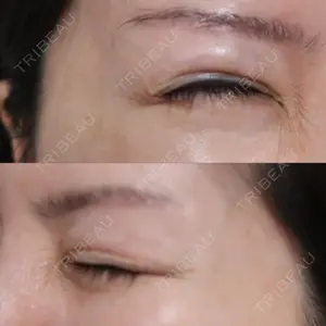 湘南美容クリニック 湘南美容クリニック 新宿南口院口コミ