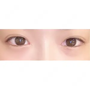 AI Beauty Clinic （エーアイ美容クリニック）口コミ