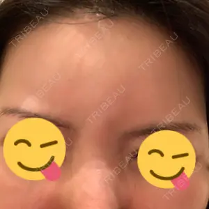 湘南美容クリニック 湘南美容クリニック 新宿南口院口コミ