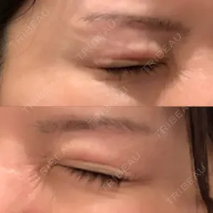 湘南美容クリニック 湘南美容クリニック 新宿南口院口コミ