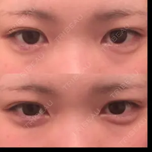 口コミ