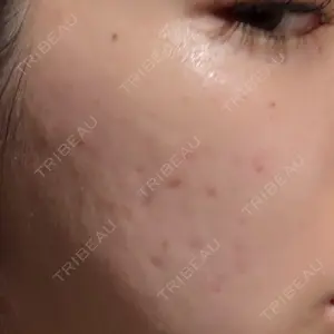 L‘amour clinic Tokyo【ラムールクリニック東京】口コミ