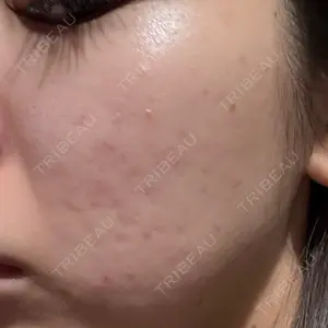 L‘amour clinic Tokyo【ラムールクリニック東京】口コミ