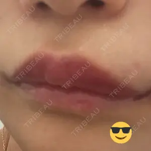 APスキンクリニック銀座口コミ