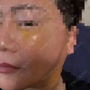 Tokyo Tensei Clinic Tokyo Tensei Clinic 新宿院口コミ