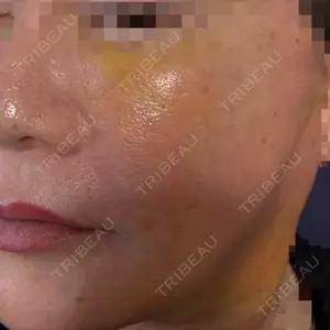 スマートスキンクリニック スマートスキンクリニック 神保町院口コミ