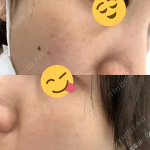 LUNA BEAUTY CLINIC 池袋駅前院口コミ