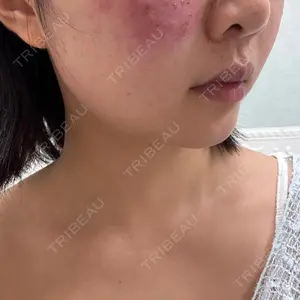 ビューティー和心クリニック 浅草院口コミ