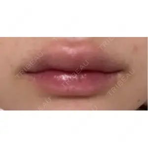 アリエル美容クリニック アリエル美容クリニック 横浜院口コミ