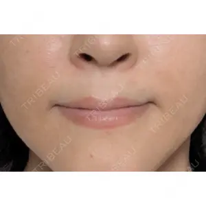 MKクリニック MKクリニック 日本橋院口コミ