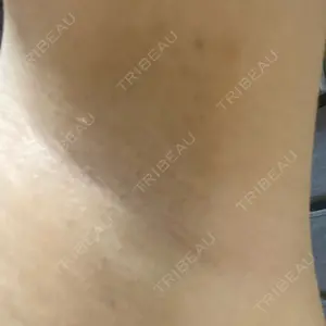 湘南美容クリニック 湘南美容クリニック 名古屋栄院口コミ