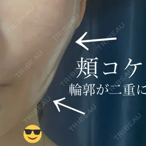 APスキンクリニック銀座口コミ