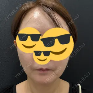 東京シンデレラ美容外科 東京シンデレラ美容外科 池袋院口コミ