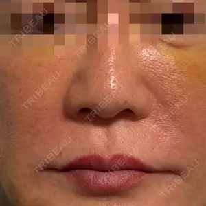 スマートスキンクリニック スマートスキンクリニック 神保町院口コミ