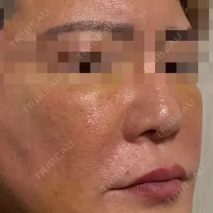 スマートスキンクリニック スマートスキンクリニック 神保町院口コミ