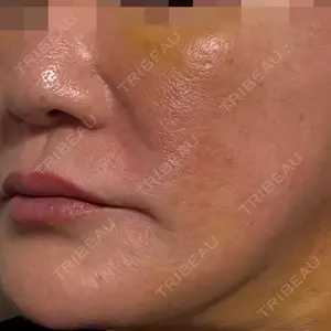 スマートスキンクリニック スマートスキンクリニック 神保町院口コミ