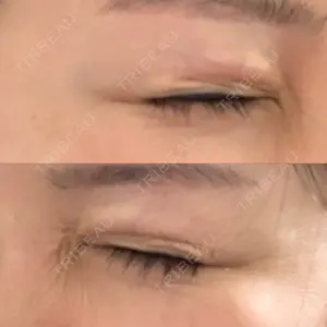 湘南美容クリニック 湘南美容クリニック 新宿南口院口コミ