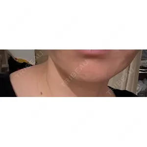 AB美容クリニック AB美容クリニック 新宿院口コミ