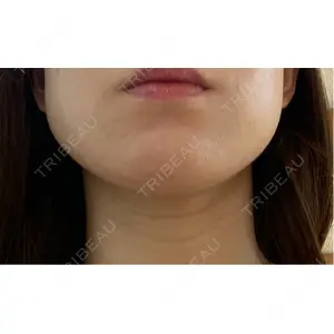 TCB東京中央美容外科 TCB東京中央美容外科 名古屋栄院口コミ