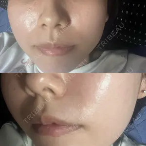 クレオビューティークリニック口コミ